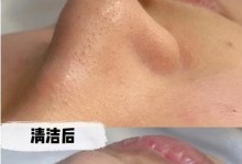 国产小气泡（革新科技助力健康生活）